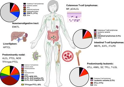 Classification and challenges in the histopathological diagnosis of peripheral T-cell lymphomas, emphasis on the WHO-HAEM5 updates